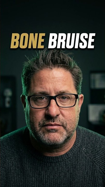Bone Bruise: Diagnosis & Recovery